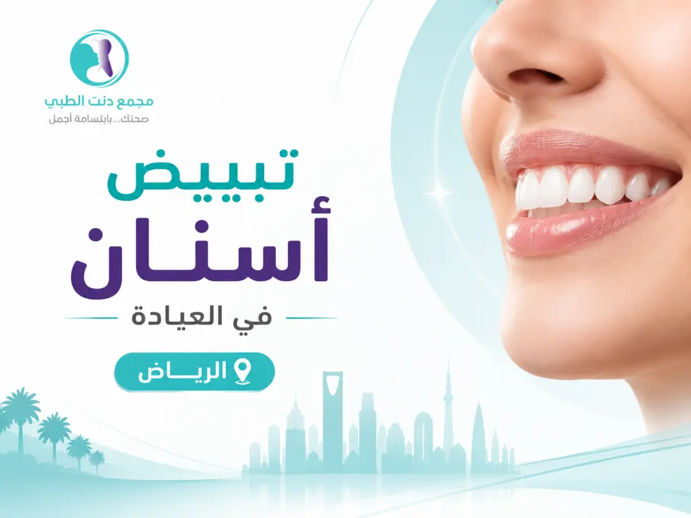 تبييض أسنان في العيادة الرياض: كيف تختار افضل طبيب اسنان