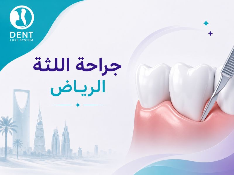جراحة اللثة الرياض