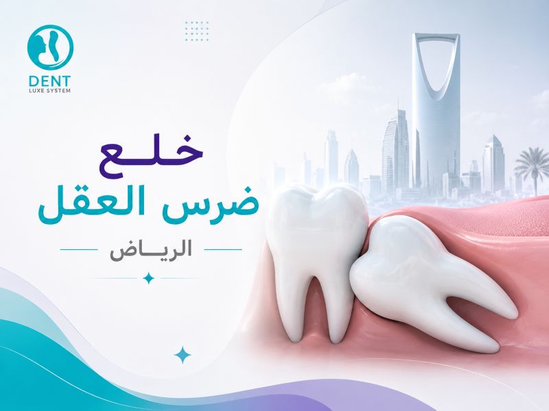 خلع ضرس العقل الجراحي في الرياض