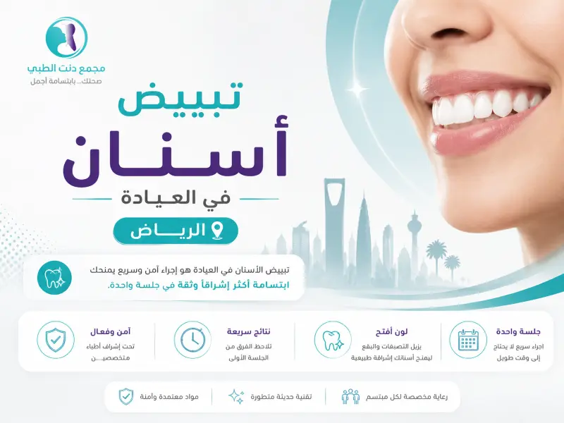 لماذا تبييض الأسنان في العيادة الرياض