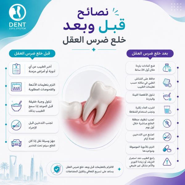 نصائح قبل وبعد خلع ضرس العقل