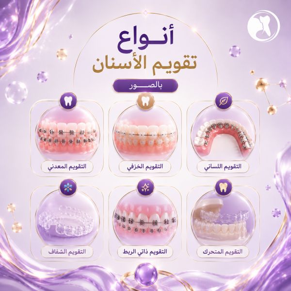 أنواع تقويم الأسنان بالصور واسعارها 