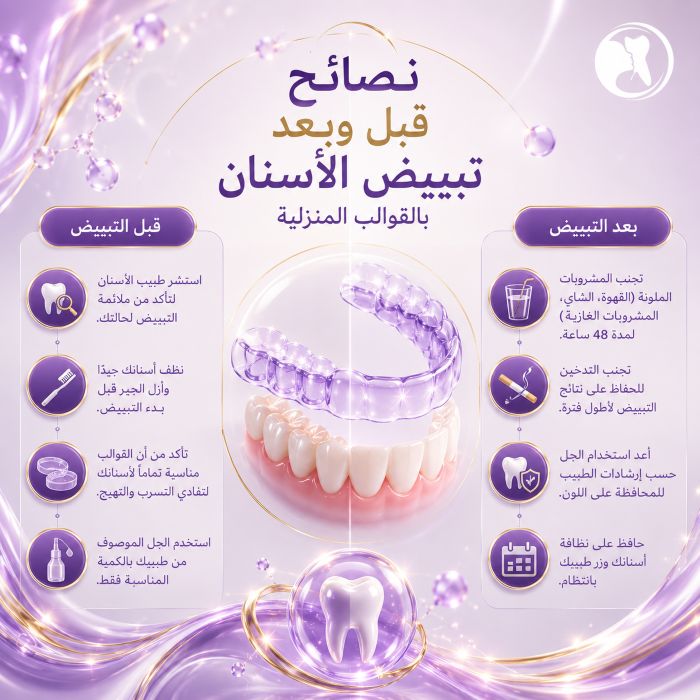 نصائح قبل وبعد تبييض الأسنان بالقوالب المنزلية