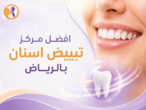 افضل مركز تبييض اسنان بالرياض: تقنيات حديثة لابتسامة مشرقة فورية