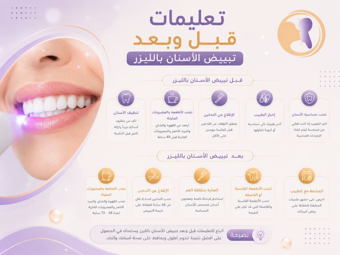 تعليمات قبل وبعد تبييض الأسنان بالليزر