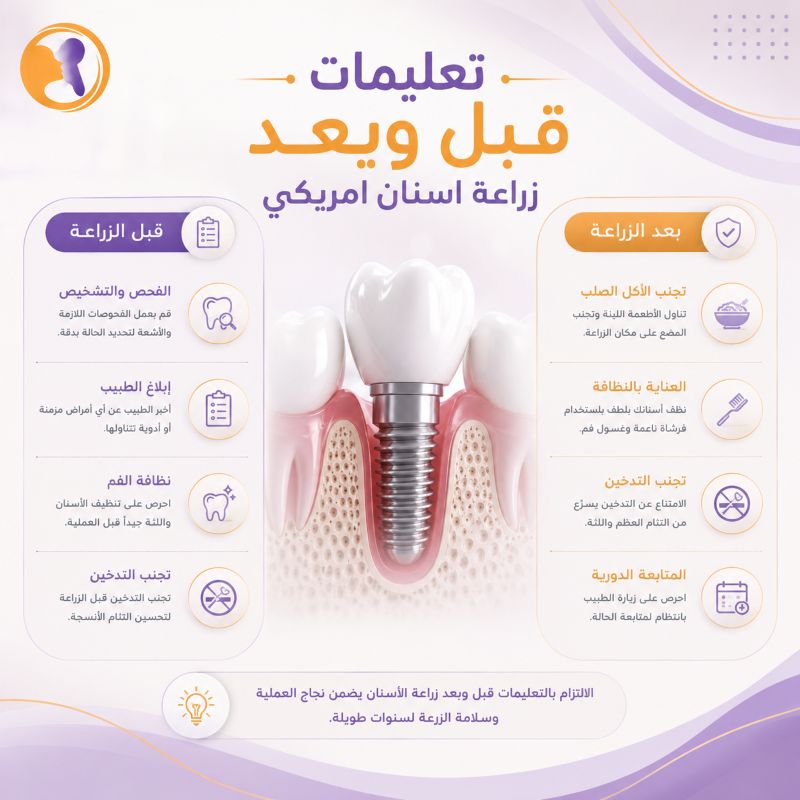 تعليمات قبل وبعد زراعة الأسنان الأمريكي