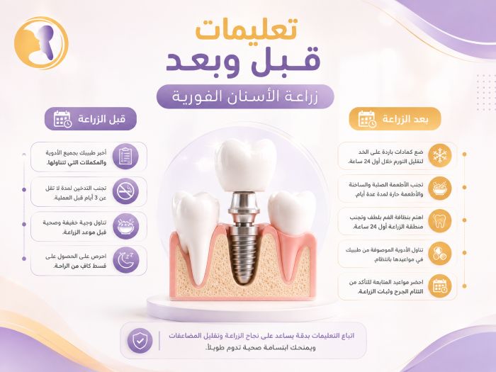 تعليمات قبل وبعد مع زراعة الأسنان الفورية