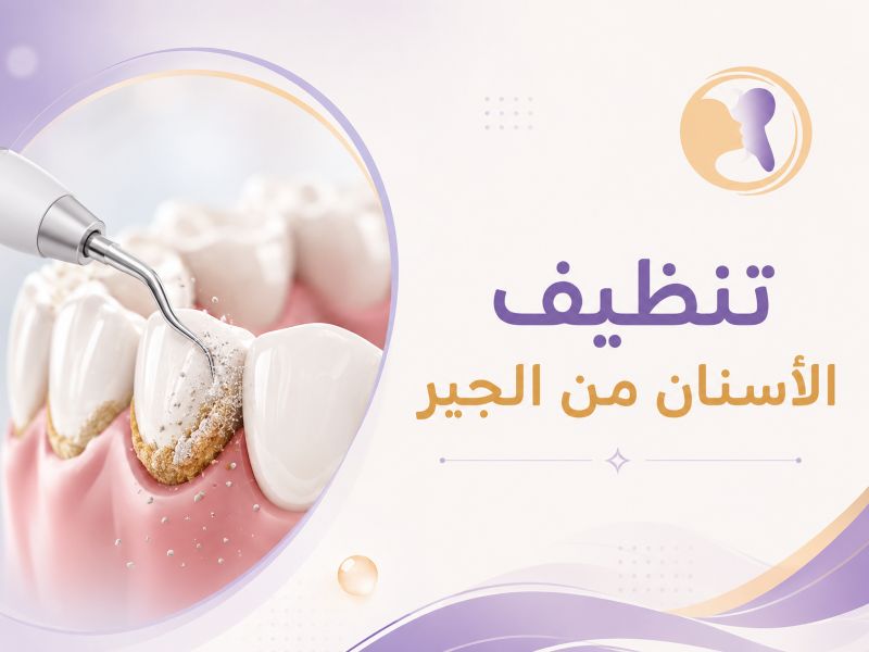 تنظيف الأسنان من الجير