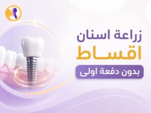 زراعة اسنان اقساط بدون دفعة اولى: ابدأ علاجك بثقة وقرار مدروس
