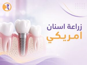 زراعة اسنان امريكي المعتمدة: حل دائم، فائق الدقة، وبدون أي ألم!