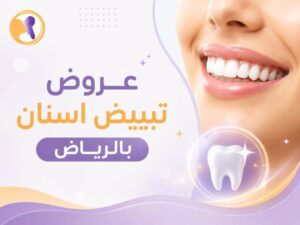 عروض تبييض اسنان بالرياض: كيف تحصل على ابتسامة مشرقة بأمان وبأفضل التقنيات الطبية؟