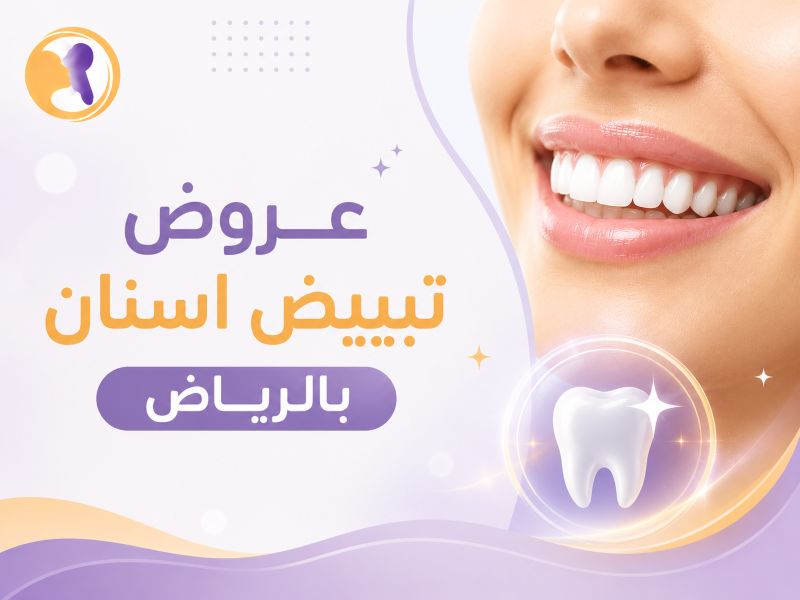عروض تبييض اسنان بالرياض