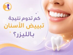 كم تدوم نتيجة تبييض الأسنان بالليزر؟ اكتشف السر لابتسامة تدوم طويلاً!