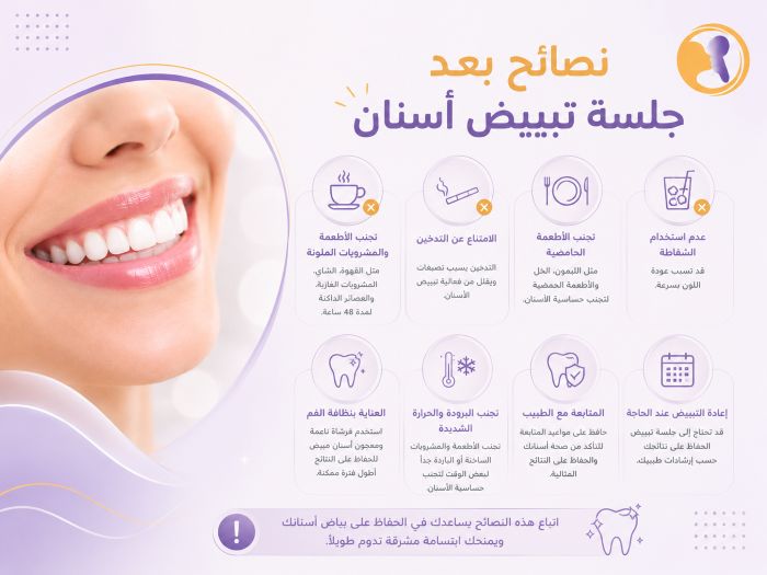 نصائح بعد جلسة تبييض أسنان