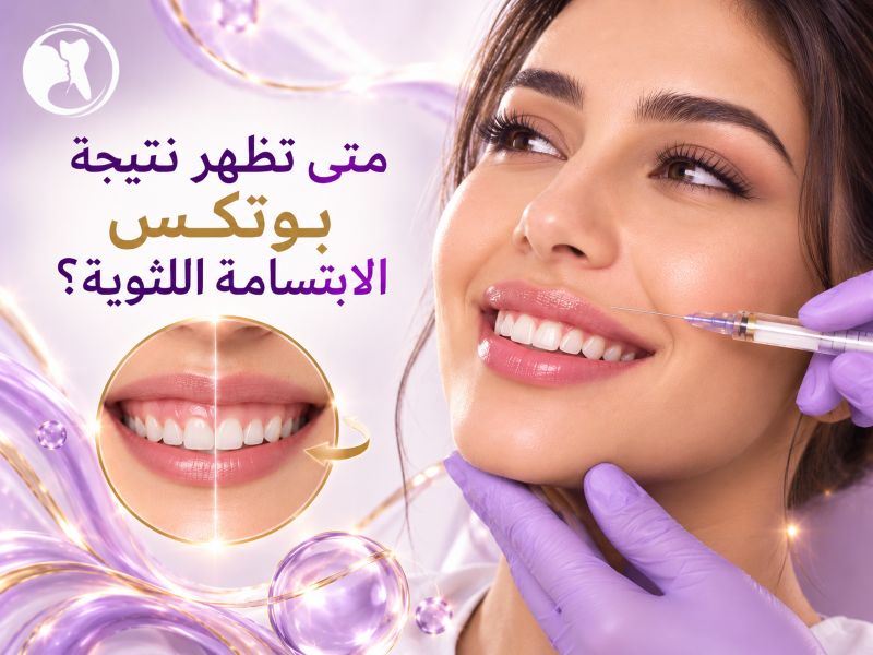 متى تظهر نتيجة بوتكس الابتسامة اللثوية