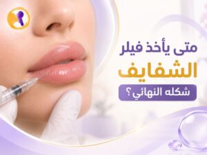 متى يأخذ فيلر الشفايف شكله النهائي؟ تعرفي على المدة والعلامات التي توضح استقرار النتيجة