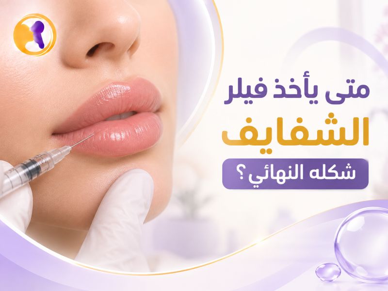 متى- يأخذ- فيلر الشفايف- شكله النهائي-
