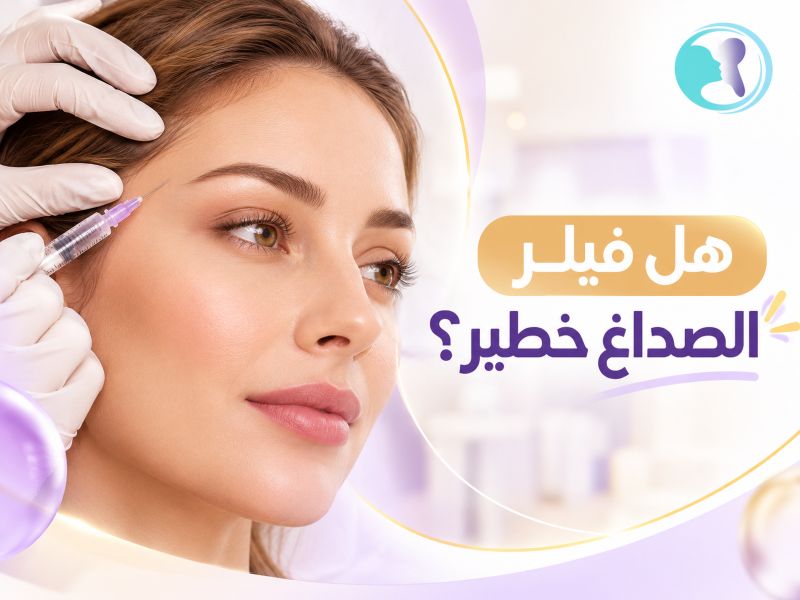 هل فيلر الاصداغ خطير؟