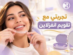 تجربتي مع تقويم انفزلاين: 12 حقيقة تحتاج معرفتها قبل بدء العلاج
