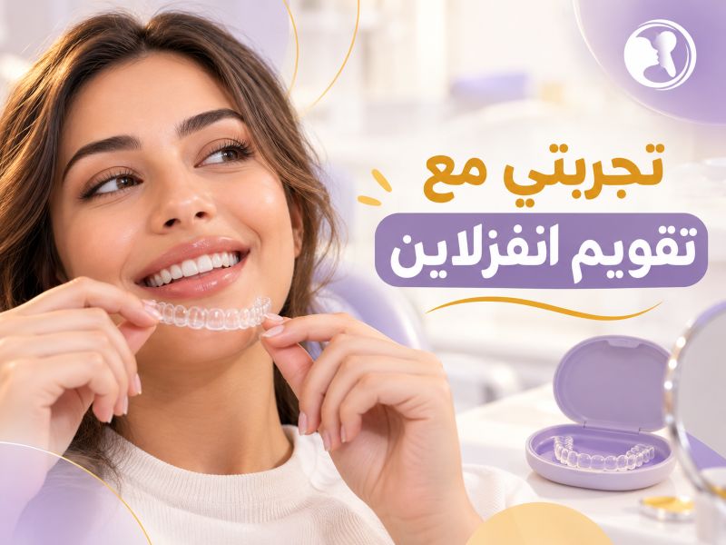 تجربتي مع تقويم انفزلاين